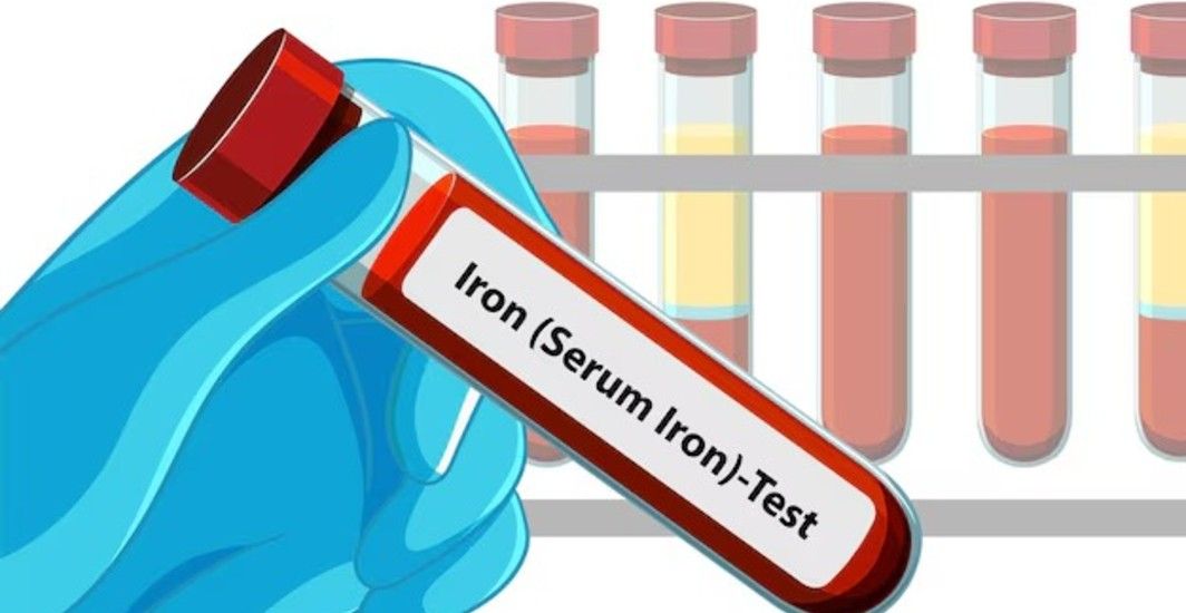 iron-studies-test-purpose-procedure-range-and-results